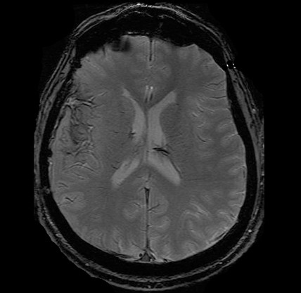 Gradient Record MRI