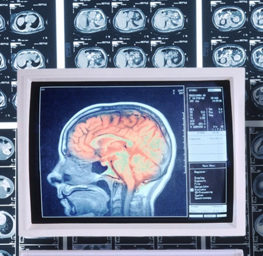 Facts about Concussion and Brain Injury: Where To Get Help