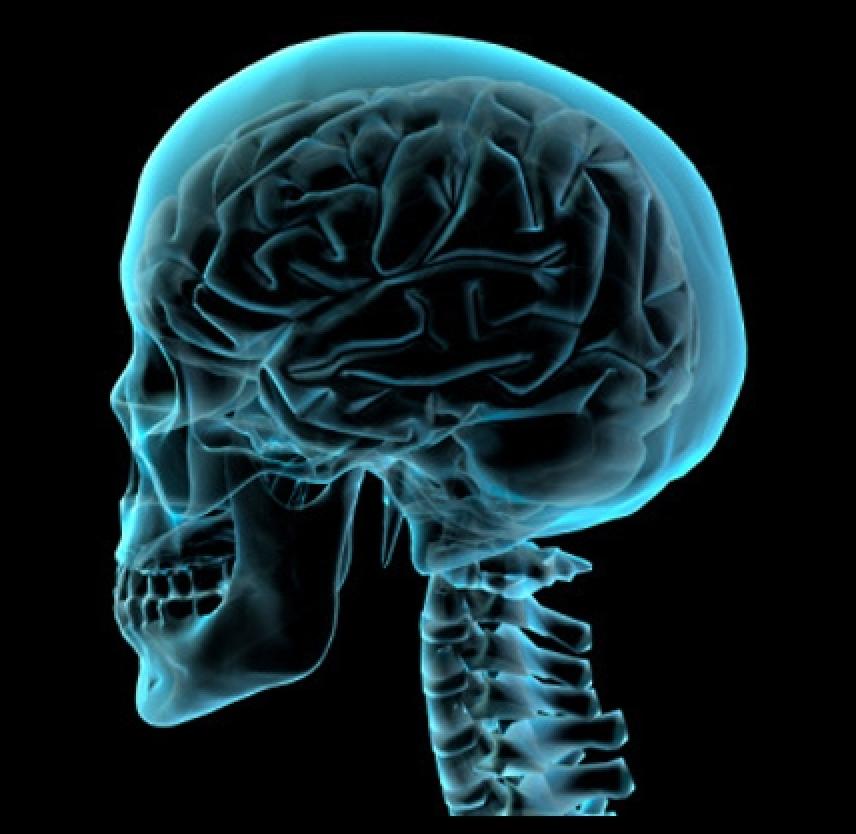 Судороги мозга. Эпилепсия мозг. Мозг эпилептика. Мозг человека с эпилепсией.