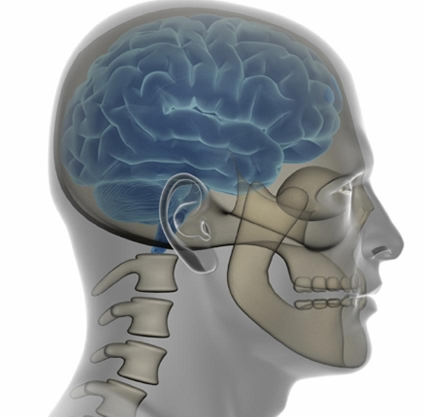 Personal Story: Sgt. Wells's New Skull