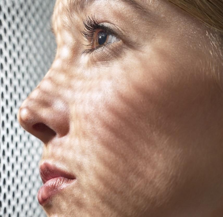 What Happens to Relationships After Brain Injury?