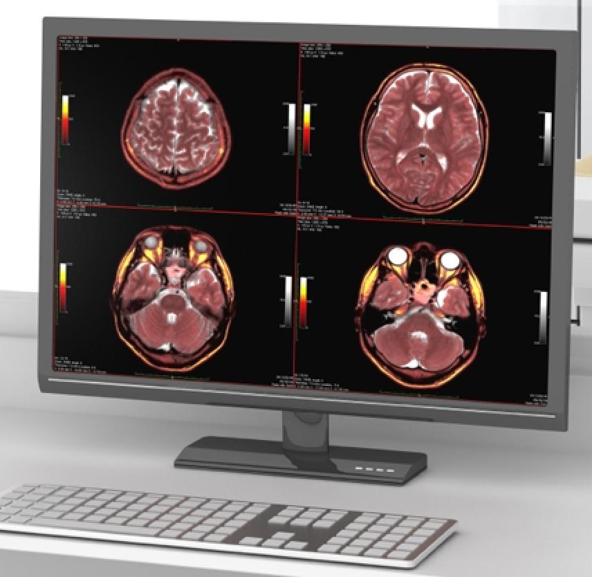 Brain Facts: A Primer on the Brain and Nervous System