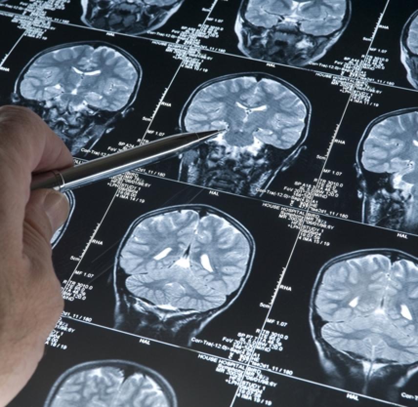 Traumatic brain injury: future assessment tools and treatment prospects