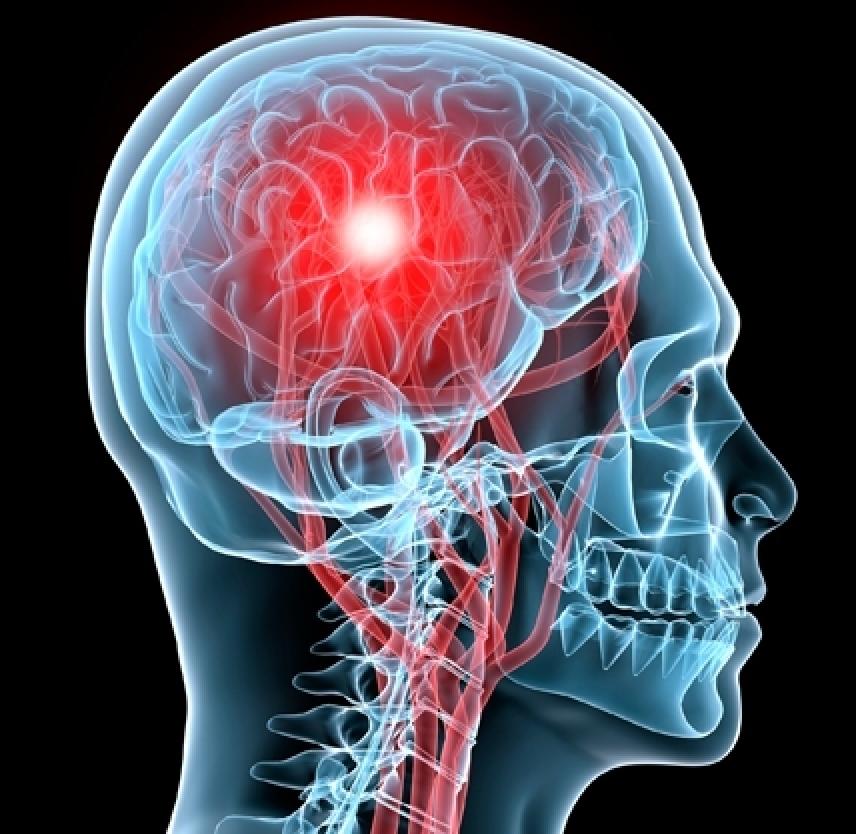 Concussion Danger Signs Brainline 