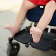 Close up photo of a girl's legs and spasticity in her muscles, she sits in a wheelchair