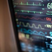 Monitor displaying vital signs