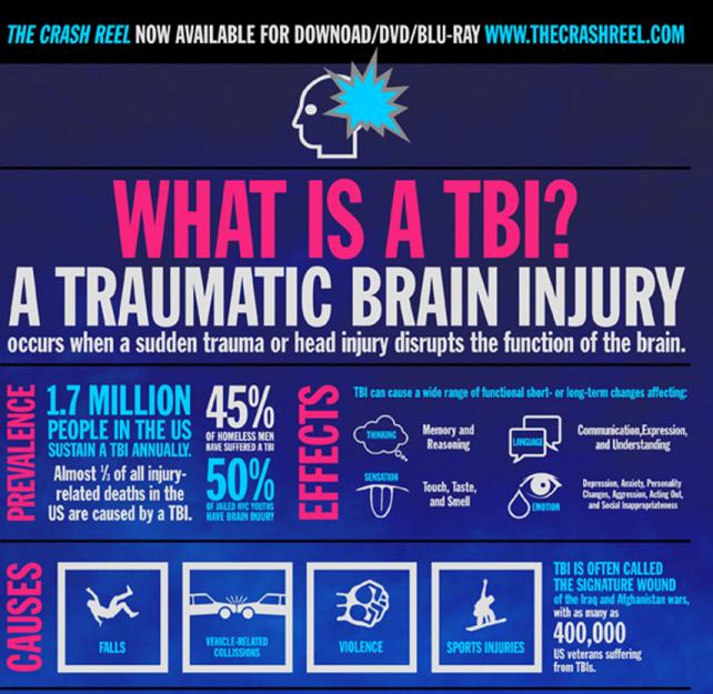 Love Your Brain: What Is A TBI? Infographic