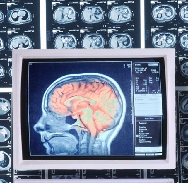 Facts about Concussion and Brain Injury: Where To Get Help