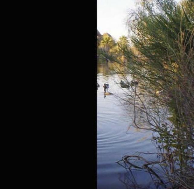 Ask the Expert: What Is Hemianopsia and Why Does It Happen After TBI?