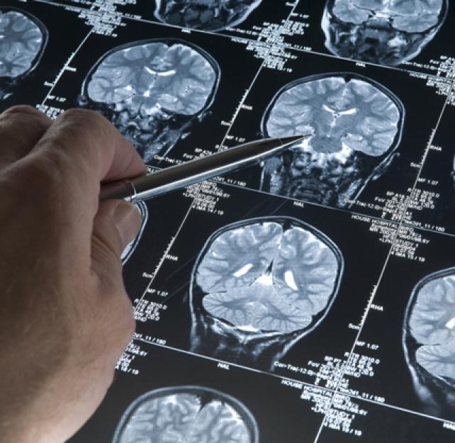 Understanding TBI, Part 3: The Recovery Process