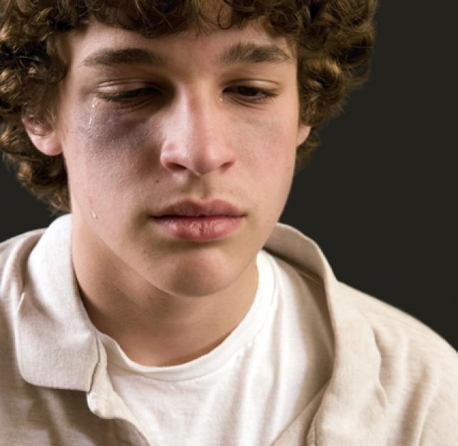 CTE from Abuse, Not Sports?