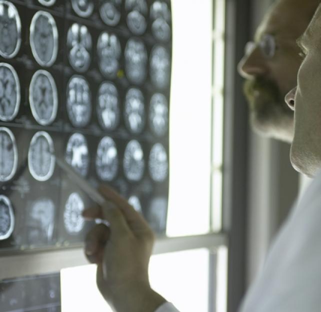 Making a Difference #1: Intro to TBI