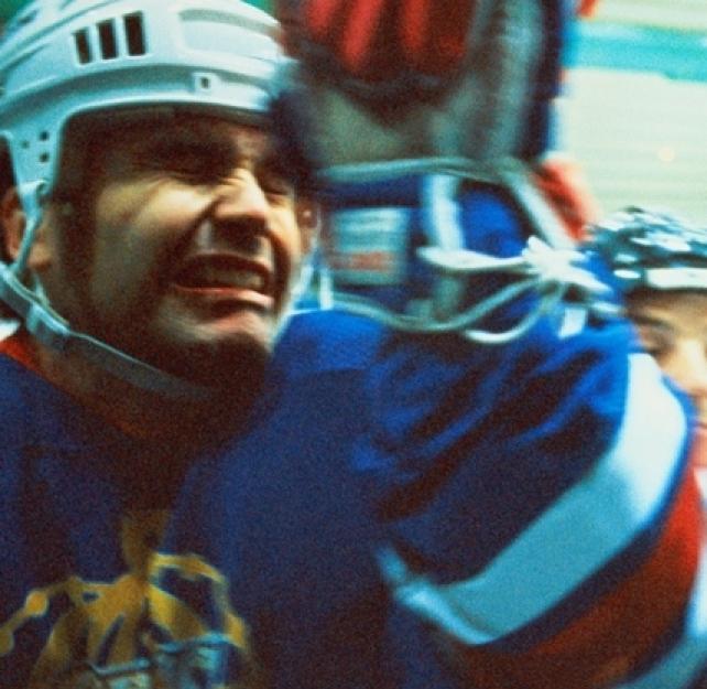 How Can We Improve the Way Sports Handle Brain Injuries?