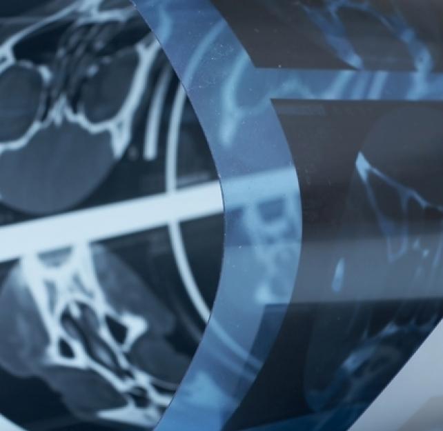 Brain Injury: What Doctors and Researchers Have Learned