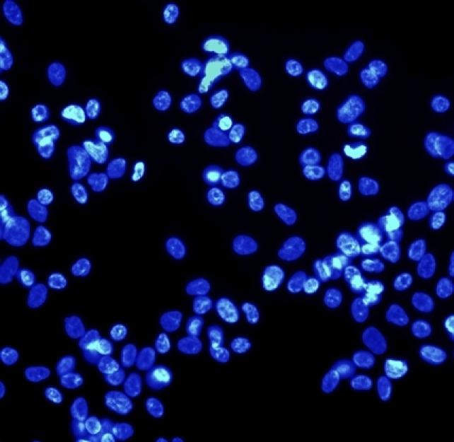 Careful, Thoughtful Stem Cell "Revival" Needed in TBI Research