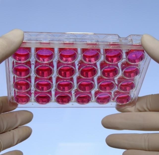 Stems Cells and Brain Injury: Slow and Steady Progress