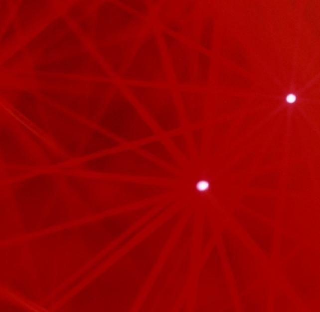 Understanding Subarachnoid Hemorrhage