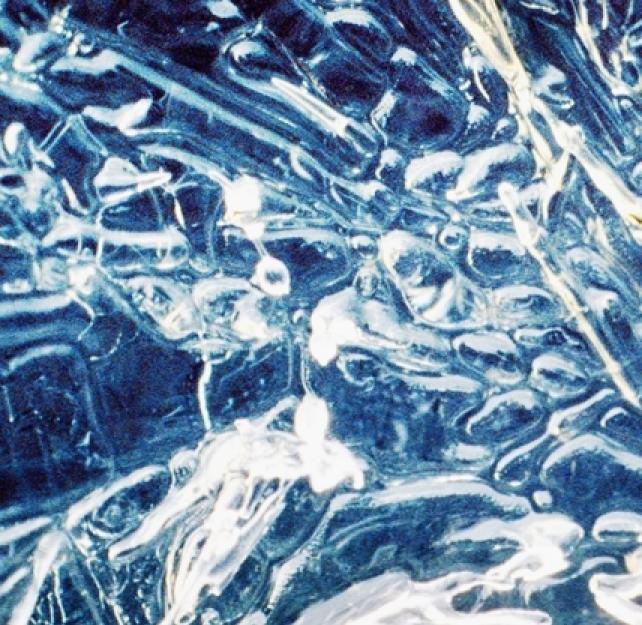 Understanding Diffuse Axonal Injury