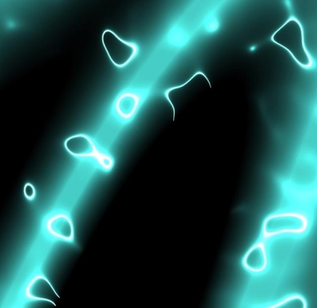 Understanding Subdural Hematoma