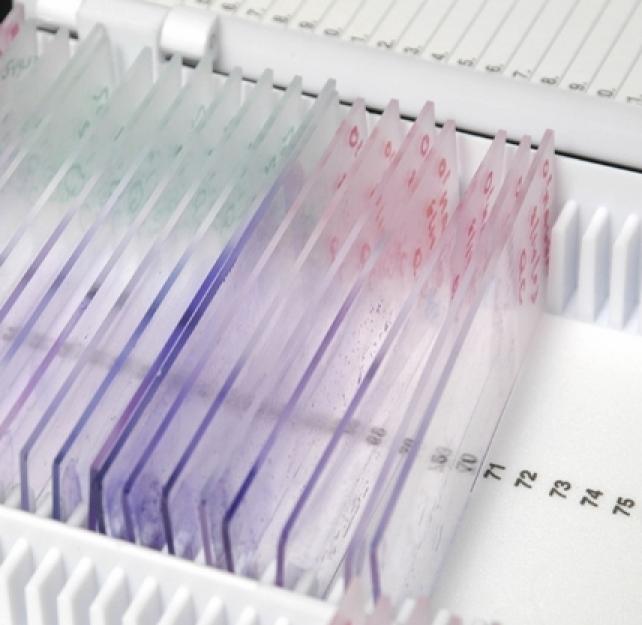 COL Dallas Hack, MD: The Research on Blood Biomarkers for Brain Injury