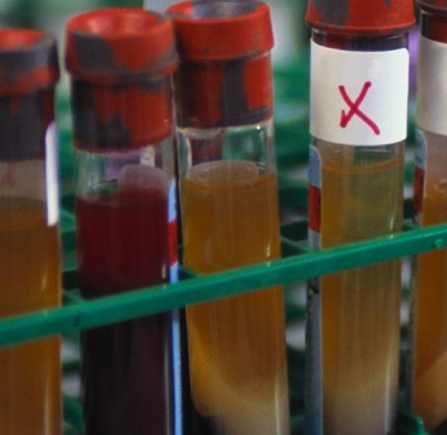 Frank Tortella, PhD: Hope for Biomarkers to Diagnose Brain Injuries