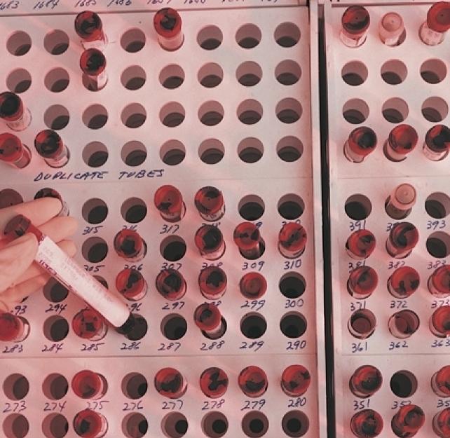 Frank Tortella, PhD: Need for Objective Diagnostic Tool for Mild TBI