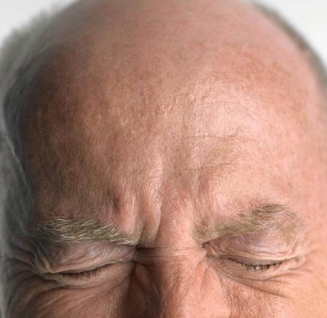 Can the Brain Itself Feel Pain?