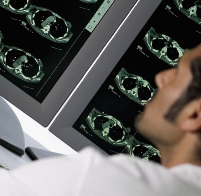 The Importance of Sensitive Neuroimaging for People with TBI