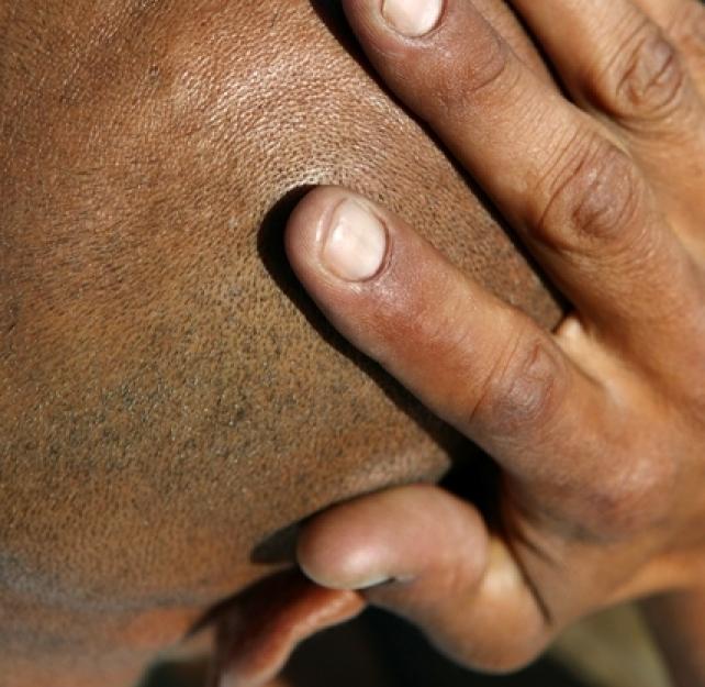 What Exactly Happens After a Concussion?