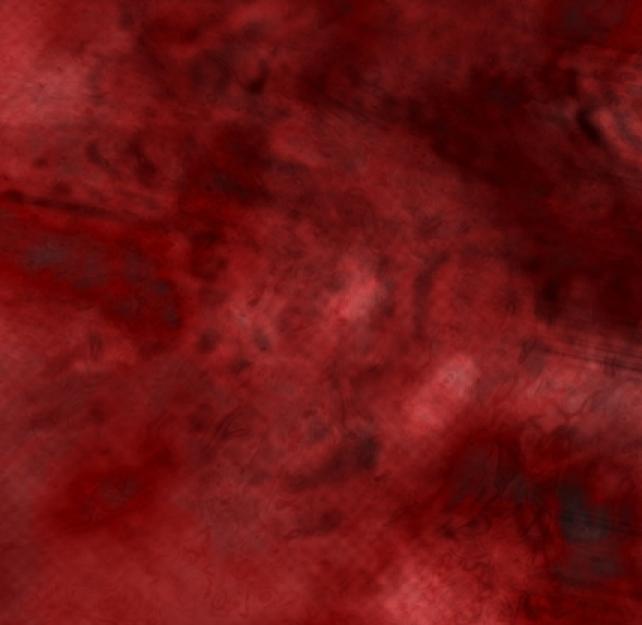 What Is Complex Regional Pain Syndrome and How Does It Relate to TBI?