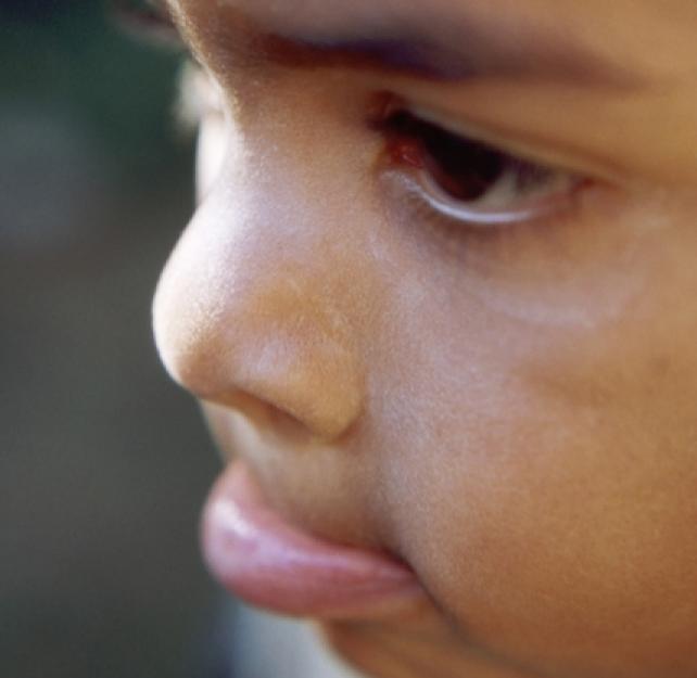 How Younger Children Often React to a Parent with TBI