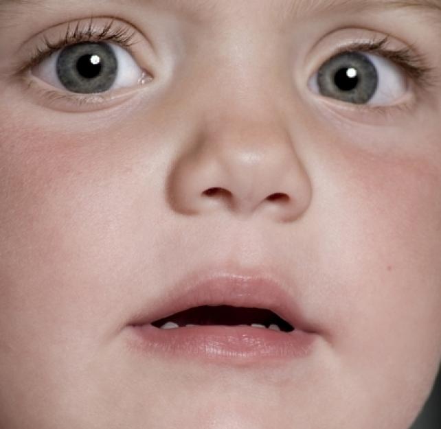 CT Scans Versus MRIs for Imaging a Child's Brain