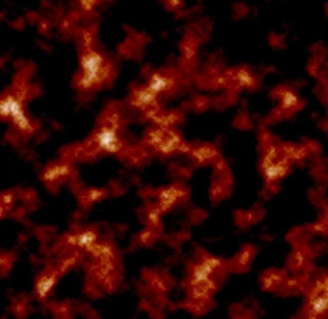 Mike Zacchea on His Severe PTSD and TBI