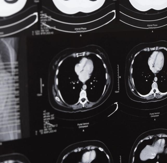 What Brain Research Is Revealing Through Neuroimaging