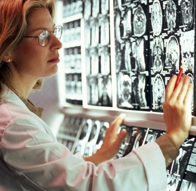 Are the Brain's Axonal Corners Particularly Vulnerable to Breakage?