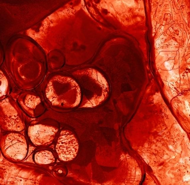 What Exactly Is a Biomarker?