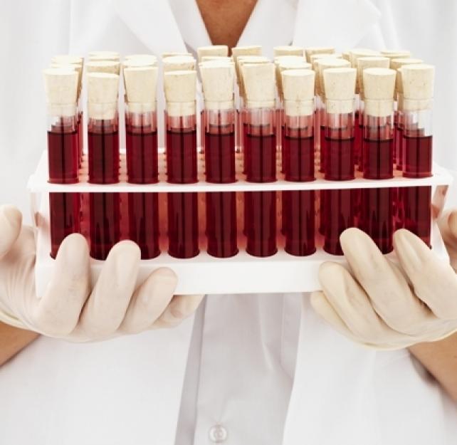 The Need for an Objective TBI Test