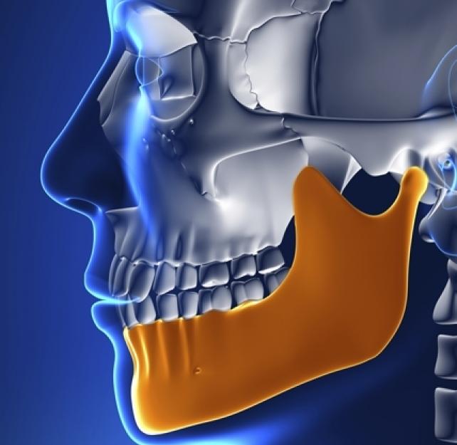 Can a Hit to the Jaw Cause TBI?