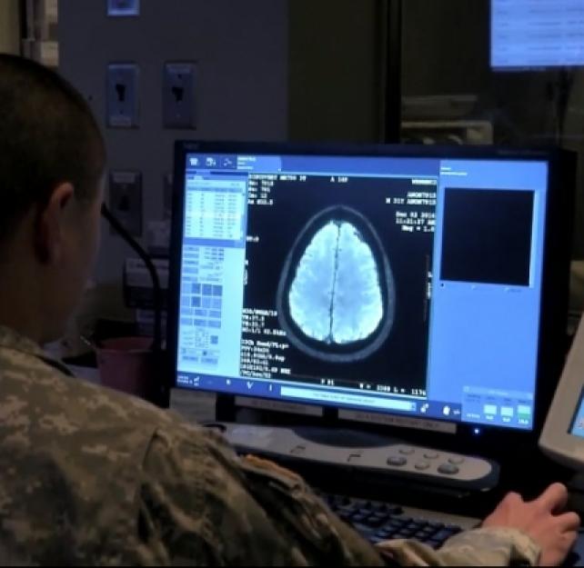 Helping People with TBI & PTSD