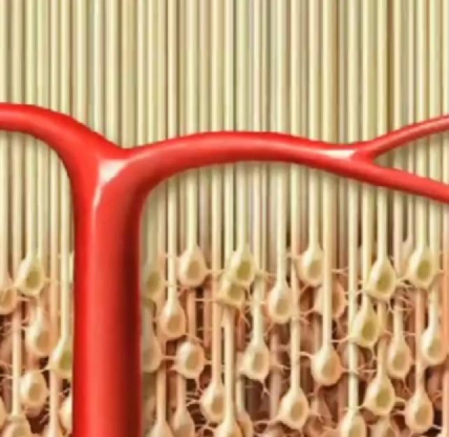 Basic Anatomy of TBI