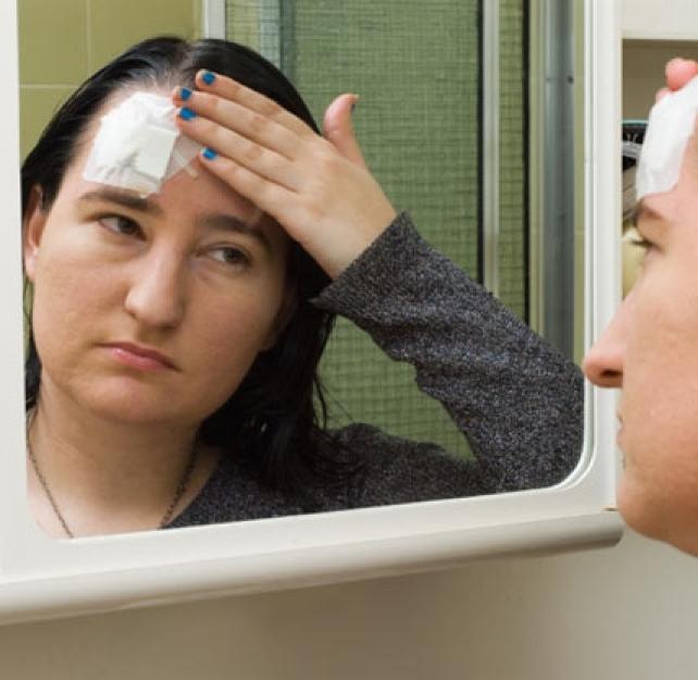 Dr. James Kelly Talks About Areas of the Brain Affected by Concussion