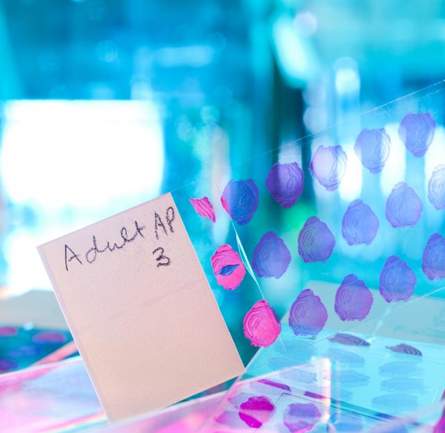 Dr. Ann McKee: We Need More Brain Donations Among Veterans in Order to Study Military CTE Dr. Ann McKee: We Need More Brain Donations Among Veterans in Order to Study Military CTE